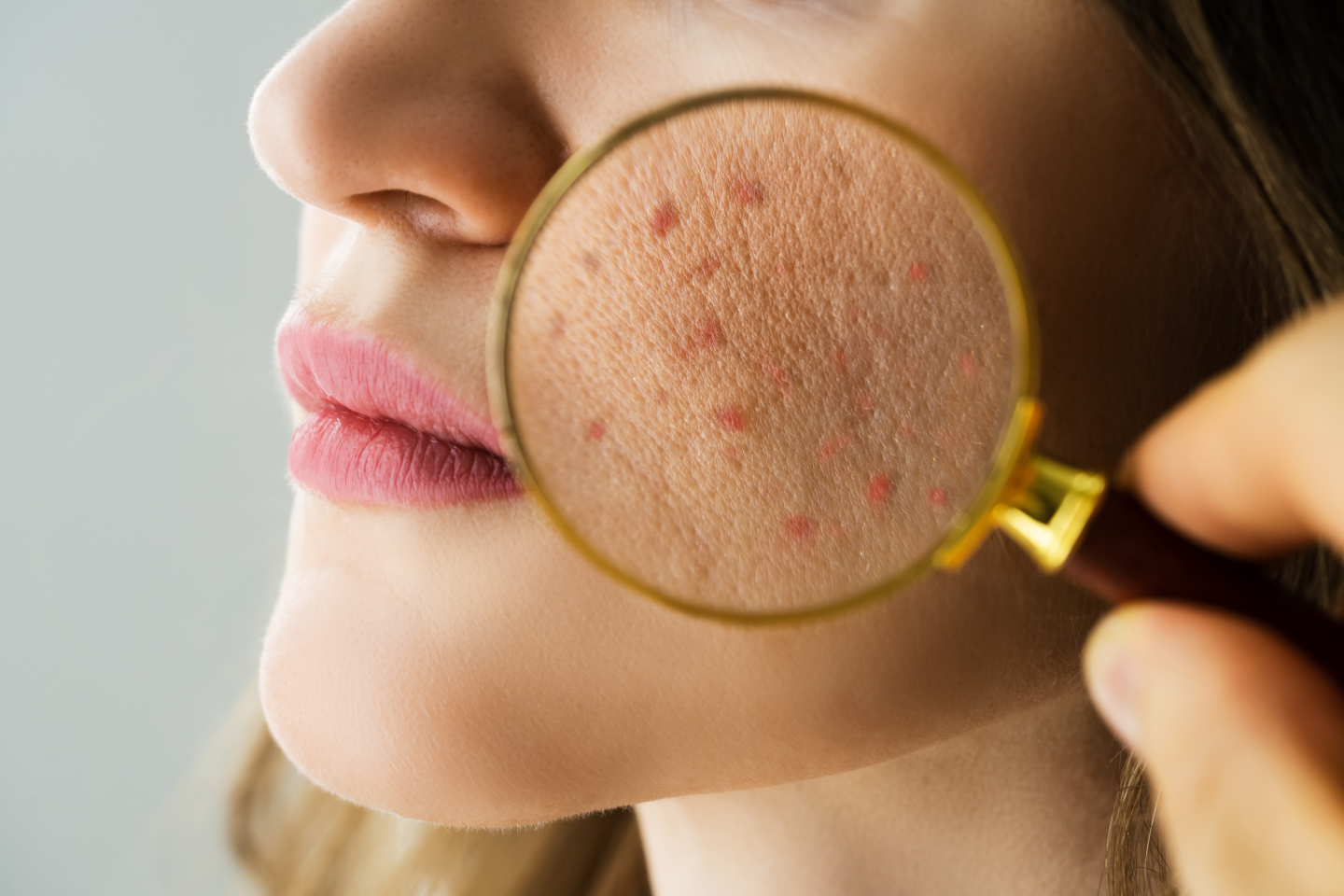 How can I prevent allergies?